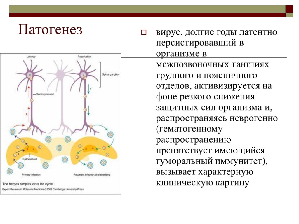 Патогенез вирус, долгие годы латентно персистировавший в организме в межпозвоночных ганглиях грудного и поясничного